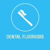 Dental fluorosis treatment, Micro abrasion & tooth bleaching, dental fluorosis treatment in Bangalore, Micro abrasion & tooth bleaching in Bangalore