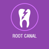 root canal treatment in Bangalore, endodontist in Bangalore, best root canal treatment in Bangalore