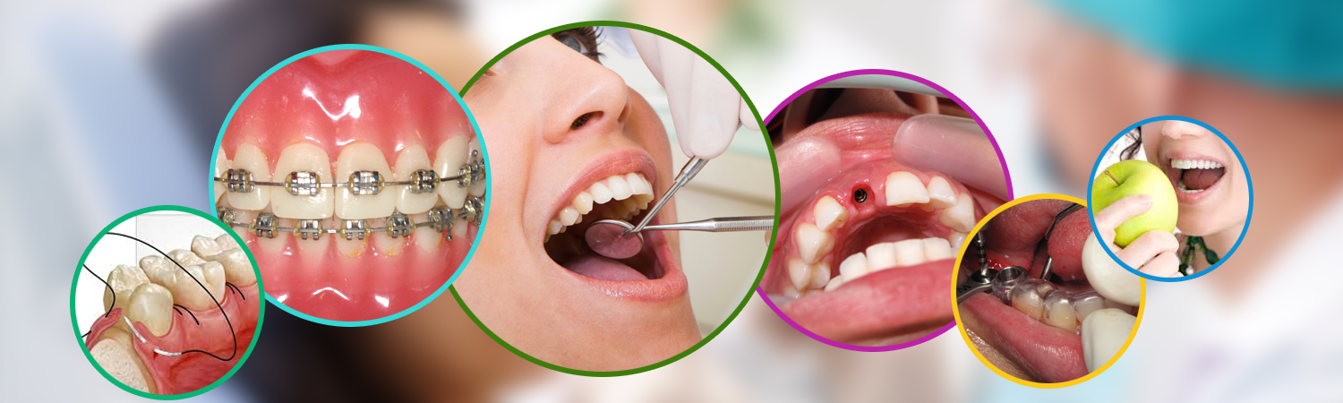 dental services in Bangalore