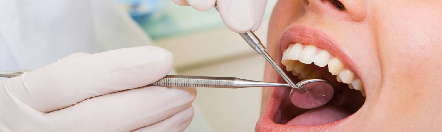 dental advantages in bangalore